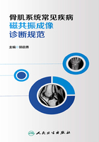 骨肌系统常见疾病磁共振成像诊断规范