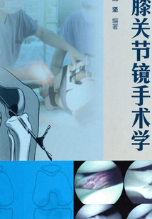 膝關節鏡手術學