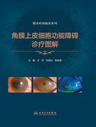 角膜上皮细胞功能障碍诊疗图解(眼表疾病临床系列)在线阅读