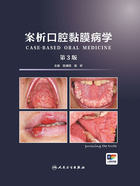 案析口腔黏膜病学(第3版)在线阅读