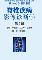 脊椎疾病影像诊断学（第2版）在线阅读
