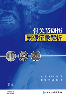 骨關節創傷影像征象解析