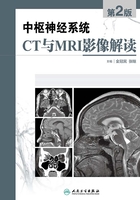 中枢神经系统CT和MRI影像解读（第2版）