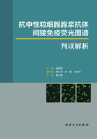 抗中性粒细胞胞浆抗体间接免疫荧光图谱判读解析在线阅读