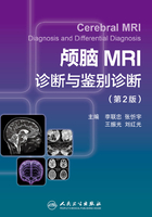 颅脑MRI诊断与鉴别诊断（第2版）