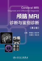 颅脑MRI诊断与鉴别诊断（第2版）在线阅读