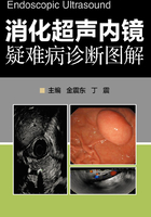 消化超声内镜疑难病诊断图解在线阅读