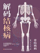 解码结核病:骨结核病在线阅读