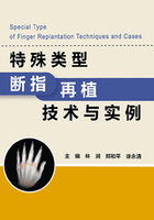 特殊类型断指再植技术与实例