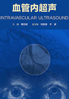 血管内超声在线阅读