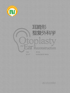 耳畸形整复外科学在线阅读