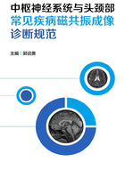 中枢神经系统与头颈部常见疾病磁共振成像诊断规范在线阅读