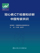 冠心病CT检查和诊断中国专家共识在线阅读