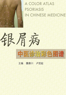 银屑病中医诊治彩色图谱