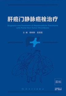 肝癌門靜脈癌栓治療