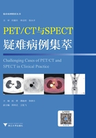 PET/CT与SPECT疑难病例集萃