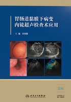 胃肠道黏膜下病变内镜超声检查术应用