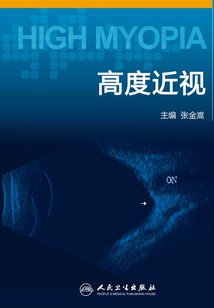 高度近視