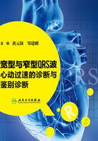 宽型与窄型QRS波心动过速的诊断与鉴别诊断在线阅读