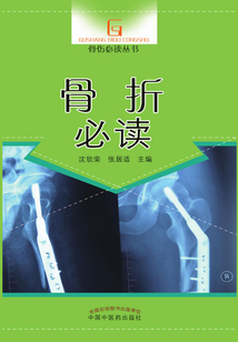 骨折必讀