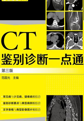 CT鉴别诊断一点通(第三版)最新章节全文无弹窗在线阅读-QQ阅读男生玄幻网