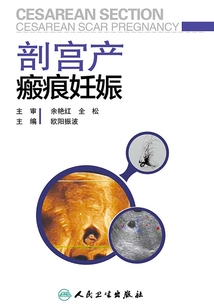 剖宮產瘢痕妊娠