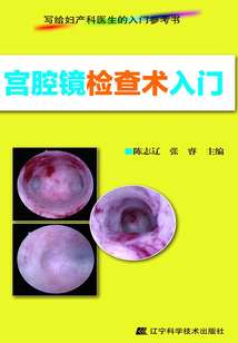 宮腔鏡檢查術(shù)入門