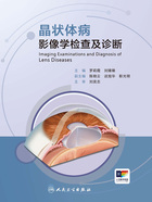 晶状体病影像学检查及诊断在线阅读