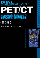 PET/CT疑难病例精解（第2版）在线阅读