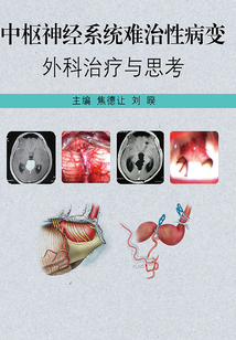 中樞神經系統難治性病變外科治療與思考