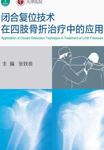 閉合復位技術在四肢骨折治療中的應用