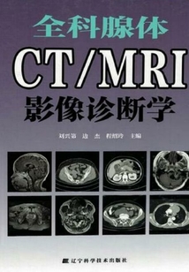 全科腺体CT/MRI影像诊断学_(刘兴第 边杰 程绍玲主编)小说最新章节全文免费在线阅读下载-QQ阅读