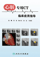 心脏专用CT临床应用指导