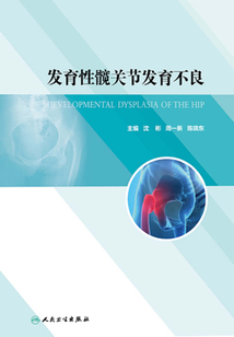 發育性髖關節發育不良