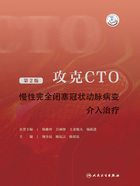 攻克CTO：慢性完全闭塞冠状动脉病变介入治疗（第2版）在线阅读