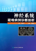 神经系统疑难病例诊断剖析在线阅读