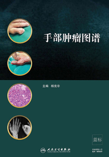 手部腫瘤圖譜