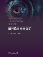 中英对照眼科临床病例荟萃在线阅读