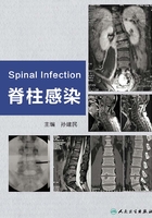 脊柱感染在线阅读