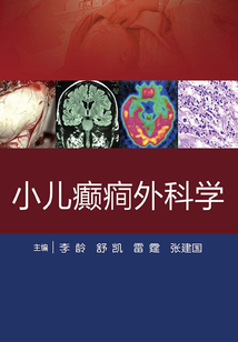 小兒癲癇外科學