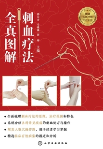 刺血療法全真圖解