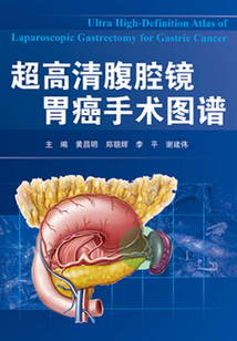 超高清腹腔鏡胃癌手術圖譜