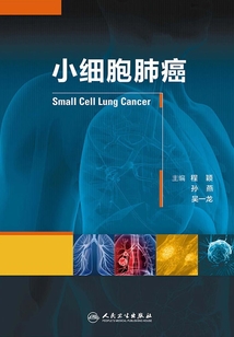 小細胞肺癌